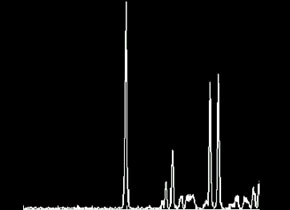 Low-SNR Brain Metabolite Estimation